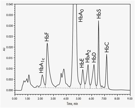 hplc graph analysis.